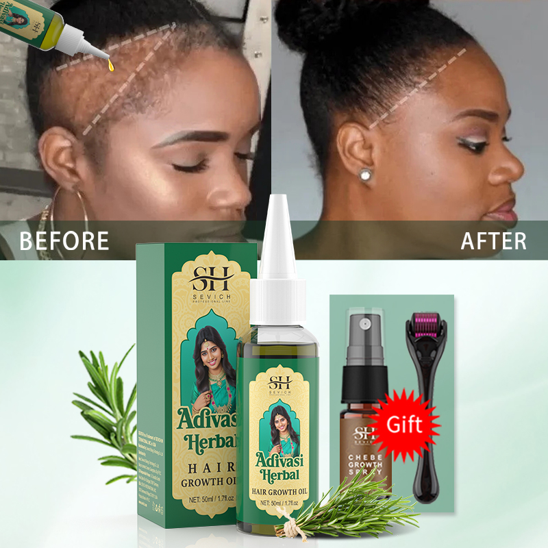 Ayurvedic Hair Growth Oil Indi - Ingrown Hair Serum recension och pris