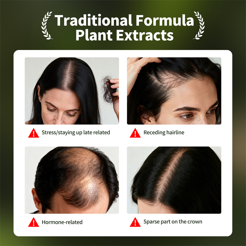 Natural Hair Growth Set Usman  - Ingrown Hair Serum recension och pris