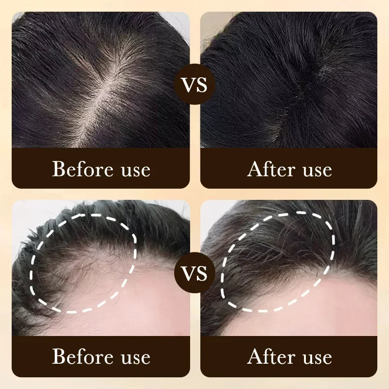 Biotin Fast Hair Growth Oil Pr - Ingrown Hair Serum recension och pris