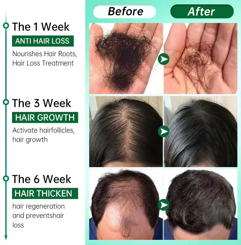 Hair Growth Serum 7 Days Fast  - Ingrown Hair Serum recension och pris