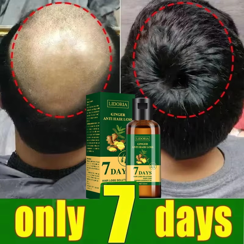 Hair Growth Serum 7 Days Fast  - Ingrown Hair Serum recension och pris
