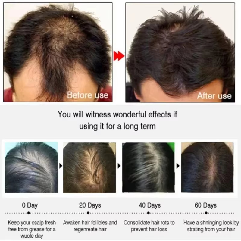 Hair Growth Serum 7 Days Fast  - Ingrown Hair Serum recension och pris