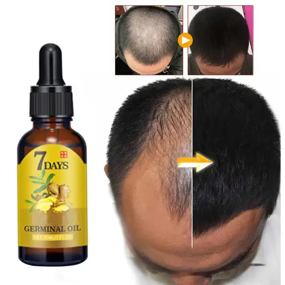 Hair Growth Ginger Fast Growin - Ingrown Hair Serum recension och pris