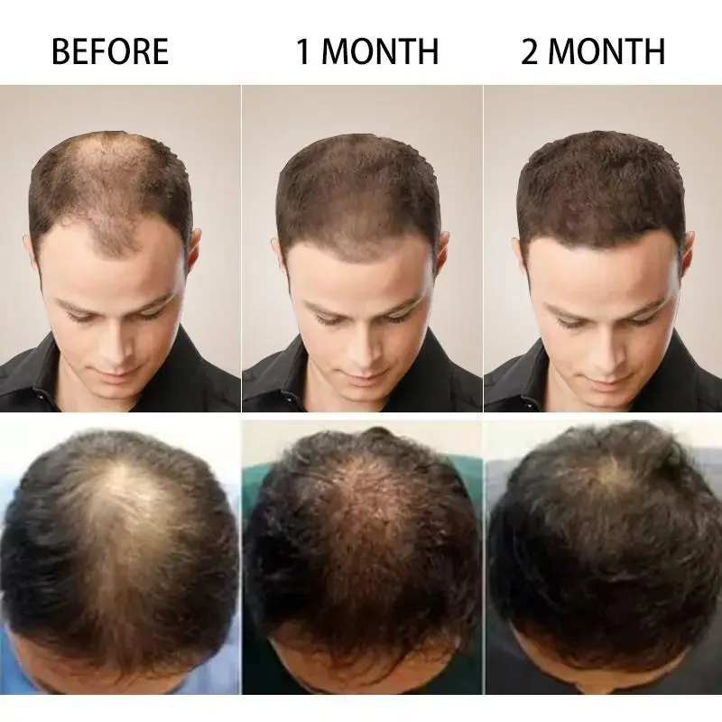 Hair Growth Ginger Fast Growin - Ingrown Hair Serum recension och pris